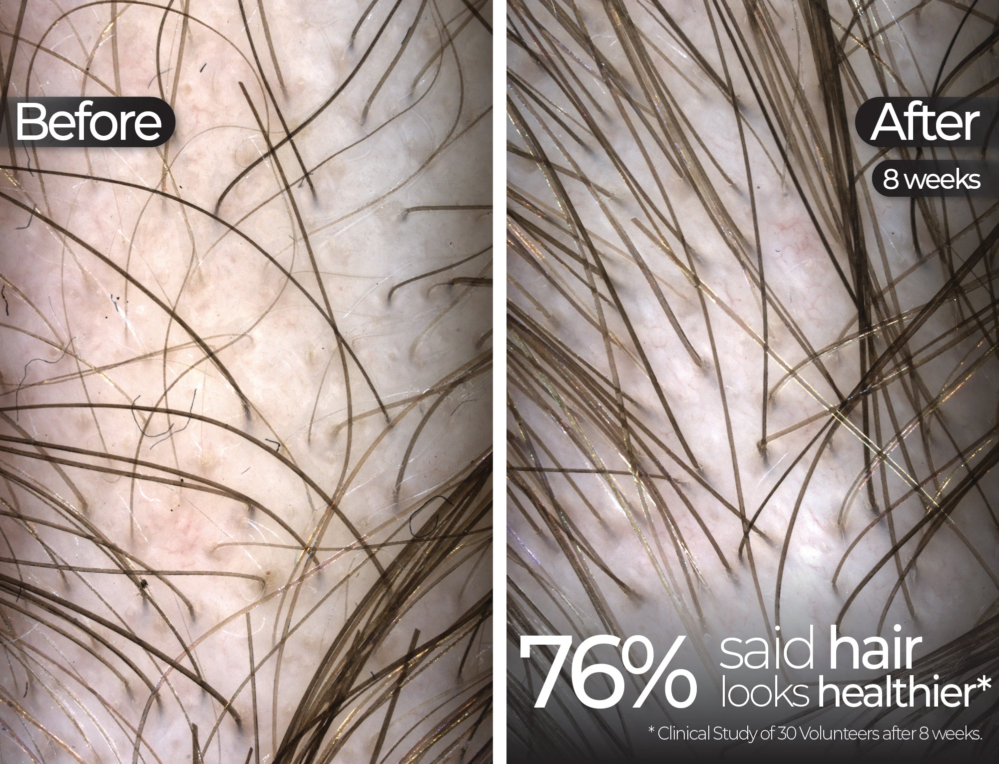 Before & After slide 1